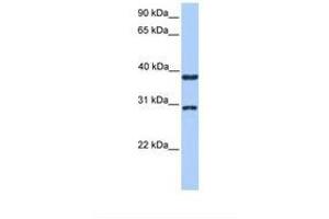 KLHDC1 anticorps  (AA 51-100)