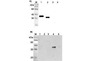 Western blot analysis using anti-ANGPTL4 (FLD) (human), pAb  at 1:2'000 dilution.