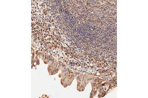 anti-Ubiquitin Specific Peptidase 15 (USP15) (AA 151-180), (N-Term) antibody