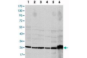 Western blot analysis using CASP8 monoclonal antibody, clone 1H11  against HeLa (1), Jurkat (2), THP-1 (3), NIH/3T3 (4), COS-7 (5) and PC-12 (6) cell lysate.