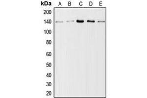 Western blot analysis of Collagen 1 alpha 2 expression in A10 (A), HeLa (B), mouse lung (C), mouse liver (D), rat liver (E) whole cell lysates.
