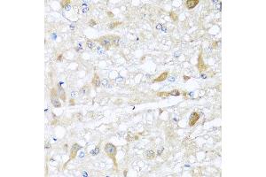 Immunohistochemistry of paraffin-embedded rat brain using CBR4 antibody at dilution of 1:100 (x40 lens). (CBR4 anticorps)