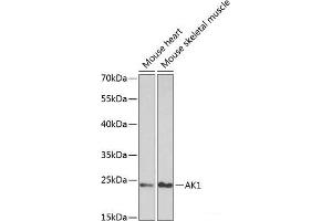 Western blot analysis of extracts of various cell lines using AK1 Polyclonal Antibody at dilution of 1:1000. (Adenylate Kinase 1 anticorps)