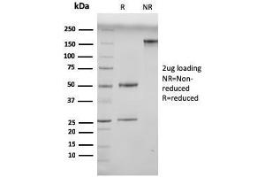 SDS-PAGE Analysis Purified N-Cadherin Mouse Monoclonal Antibody (13A9).