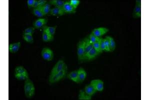 Immunofluorescence staining of HepG2 cells with ABIN7174072 at 1:100, counter-stained with DAPI. (ROR2 anticorps  (AA 752-926))