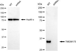 Western blotting analysis using TMEM173 antibody (ABIN7800620).