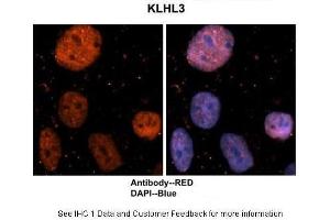 Sample Type : Human brain stem cells Primary Antibody Dilution : 1:500 Secondary Antibody : Goat anti-rabbit Alexa-Fluor 594 Secondary Antibody Dilution : 1:1000 Color/Signal Descriptions : KLHL3: Red DAPI:Blue Gene Name : KLHL3 Submitted by : Dr. (KLHL3 anticorps  (N-Term))