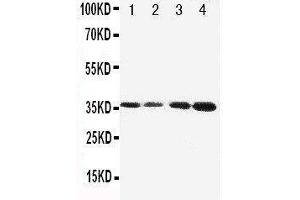 Anti-Protein C antibody, Western blotting Lane 1: JURKAT Cell Lysate Lane 2: CEM Cell Lysate Lane 3: SMMC Cell Lysate Lane 4: HELA Cell Lysate (PROC anticorps  (C-Term))