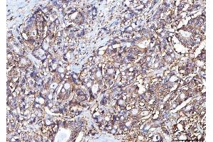 IHC analysis of Poliovirus Receptor/PVR using anti-Poliovirus Receptor/PVR antibody (ABIN7601071). (Poliovirus Receptor anticorps  (AA 28-331))