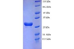 SDS-PAGE (SDS) image for Cholinergic Receptor, Muscarinic 3 (CHRM3) (AA 253-492) protein (His tag) (ABIN5713360)