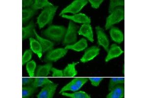 Immunofluorescence analysis of A549 cells using IFNA1 Polyclonal Antibody (IFNA1 anticorps)