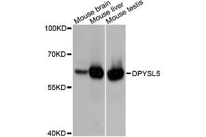 Western blot analysis of extracts of various cell lines, using DPYSL5 antibody (ABIN4903380) at 1:3000 dilution. (DPYSL5 anticorps)
