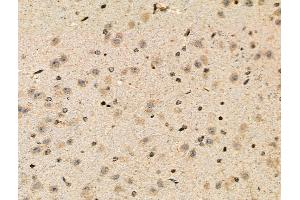 Phospho-Parkin (Ser378) Antibody at 1/100 staining Mouse brain tissue by IHC-P. (Parkin anticorps  (pSer378))