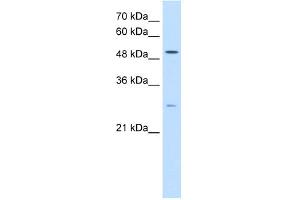 WB Suggested Anti-RRP1 Antibody Titration:  0. (RRP1 anticorps  (C-Term))