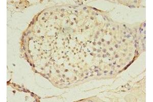 Immunohistochemistry of paraffin-embedded human testis tissue using ABIN7159638 at dilution of 1:100 (TET3 anticorps  (AA 72-335))