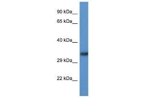 Western Blot showing ACBD6 antibody used at a concentration of 1. (ACBD6 anticorps  (Middle Region))