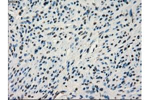 Immunohistochemical staining of paraffin-embedded colon tissue using anti-IRF3mouse monoclonal antibody. (IRF3 anticorps)