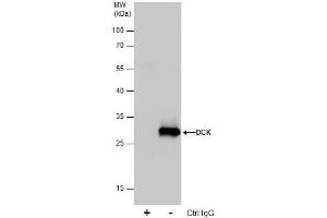 IP Image Immunoprecipitation of DCK protein from 293T whole cell extracts using 5 μg of DCK antibody, Western blot analysis was performed using DCK antibody, EasyBlot anti-Rabbit IgG  was used as a secondary reagent. (DCK anticorps  (Center))