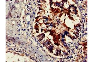 Immunohistochemistry of paraffin-embedded human lung tissue using ABIN7164202 at dilution of 1:100 (TSR2 anticorps  (AA 1-191))