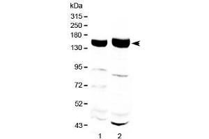 Western blot testing of 1) rat liver and 2) mouse liver with Xanthine Oxidase antibody at 0. (XDH anticorps)