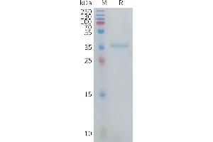 Human Protein, hFc Tag on SDS-PAGE under reducing condition.