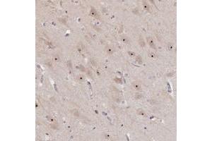 Immunohistochemical staining of human hippocampus with MGA polyclonal antibody  shows nucleolar positivity in neuronal cells at 1:500-1:1000 dilution. (MGA anticorps)