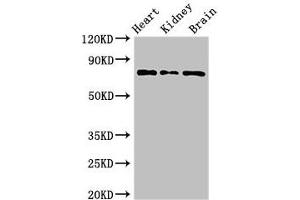 Western Blot Positive WB detected in: Mouse heart tissue, Mouse kidney tissue, Mouse brain tissue All lanes: OVGP1 antibody at 3 μg/mL Secondary Goat polyclonal to rabbit IgG at 1/50000 dilution Predicted band size: 76 kDa Observed band size: 76 kDa (OVGP1 anticorps  (AA 484-678))