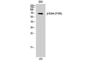 Western Blotting (WB) image for anti-Ezrin (EZR) (pTyr146) antibody (ABIN3182305) (Ezrin anticorps  (pTyr146))
