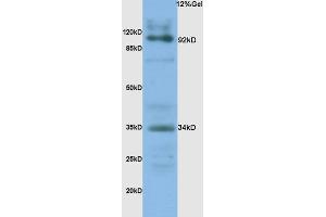 L1 human colon carcinoma lysates probed with Anti- CD138/Syndecan-1 Polyclonal Antibody, Unconjugated (ABIN674769) at 1:200 overnight at 4 °C. (Syndecan 1 anticorps  (AA 201-310))