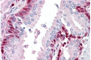 Anti-LRRFIP1 antibody IHC staining of human prostate.