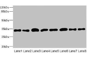 Western blot All lanes: TMBIM1 antibody at 8 μg/mL Lane 1: U251 whole cell lysate Lane 2: K562 whole cell lysate Lane 3: A549 whole cell lysate Lane 4: MCF-7 whole cell lysate Lane 5: Mouse lung tissue Lane 6: Mouse liver tissue Lane 7: Mouse kidney tissue Lane 8: Human placenta tissue Secondary Goat polyclonal to rabbit IgG at 1/10000 dilution Predicted band size: 35 kDa Observed band size: 35 kDa (TMBIM1 anticorps  (AA 1-109))