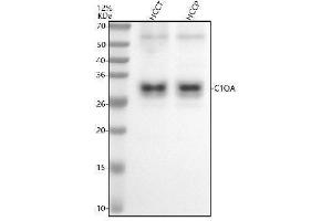 Western blot analysis of C1QA using anti-C1QA antibody (ABIN7604174).