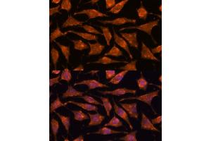 anti-Abhydrolase Domain Containing 4 (ABHD4) (AA 223-342) antibody