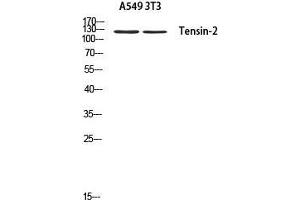 Western Blot (WB) analysis of A549 3T3 using Tensin-2 antibody. (TENC1 anticorps)