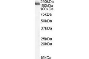 ABIN2564012 (2µg/ml) staining of Human Liver lysate (35µg protein in RIPA buffer). (MYO9B anticorps  (Internal Region))