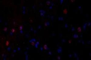 Immunofluorescent analysis of paraformaldehyde-fixed mouse spinal cord using GDF6 (ABIN7074132) at dilution of 1: 650