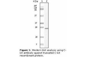 Image no. 1 for anti-Mast/stem Cell Growth Factor Receptor (KIT) antibody (ABIN232128) (KIT anticorps)