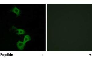 Immunofluorescence analysis of MCF-7 cells, using DAB1 polyclonal antibody . (DAB1 anticorps)