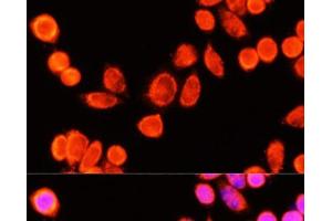 Immunofluorescence analysis of Hela cells using GSTK1 Polyclonal Antibody at dilution of 1:100 (40x lens). (GSTK1 anticorps)