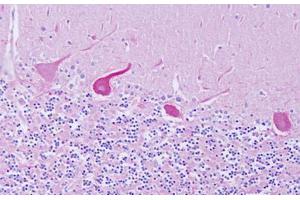 Image no. 2 for anti-GEM Interacting Protein (GMIP) (AA 804-853) antibody (ABIN6749798)