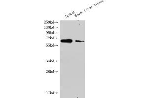 Western Blot Positive WB detected in: GPC3 antibody at 1:1000 Lane 1: Jurkat whole cell lysate Lane 2: Mouse liver tissue Secondary Goat polyclonal to Mouse IgG at 1/20000 dilution Predicted band size: 65-70KDa Observed band size: 65-70 KDa Exposure time: 5 min (Histone 3 anticorps  (AA 25-559))