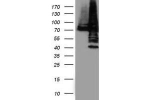 Western Blotting (WB) image for anti-Protein Disulfide Isomerase Family A, Member 4 (PDIA4) antibody (ABIN1500108) (PDIA4 anticorps)