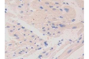 Detection of LAMa4 in Mouse Cardiac Muscle Tissue using Polyclonal Antibody to Laminin Alpha 4 (LAMa4)