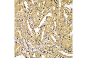 Immunohistochemistry of paraffin-embedded mouse kidney using UBE2Z antibody at dilution of 1:100 (40x lens). (UBE2Z anticorps)