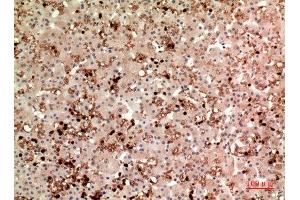 Immunohistochemistry (IHC) analysis of paraffin-embedded Human Liver, antibody was diluted at 1:100. (Thrombopoietin anticorps  (Internal Region))