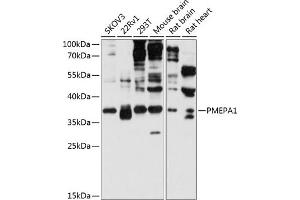 Western blot analysis of extracts of various cell lines, using PMEP antibody (2171) at 1:3000 dilution. (PMEPA1 anticorps  (AA 173-252))