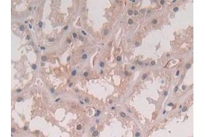 Detection of IL5 in Human Kidney Tissue using Polyclonal Antibody to Interleukin 5 (IL5)