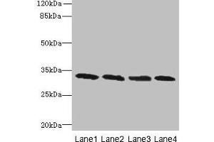 Western blot All lanes: PNP antibody at 16 μg/mL Lane 1: Jurkat whole cell lysate Lane 2: K562 whole cell lysate Lane 3: U937 whole cell lysate Lane 4: 293T whole cell lysate Secondary Goat polyclonal to rabbit IgG at 1/10000 dilution Predicted band size: 33 kDa Observed band size: 33 kDa (PNP anticorps  (AA 1-289))