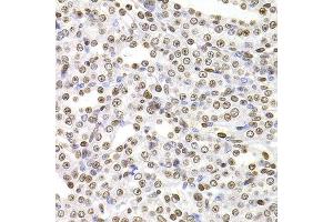 Immunohistochemistry of paraffin-embedded rat kidney using SOX5 antibody at dilution of 1:100 (x400 lens). (SOX5 anticorps)