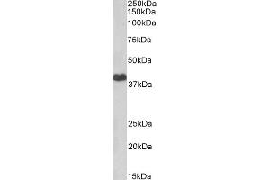Image no. 1 for anti-Protein Kinase A, alpha (PRKACA) antibody (ABIN5904323) (PRKACA anticorps)